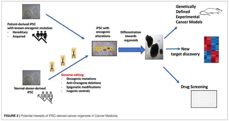 Generation of cancer organoids and following application in cancer medicine.