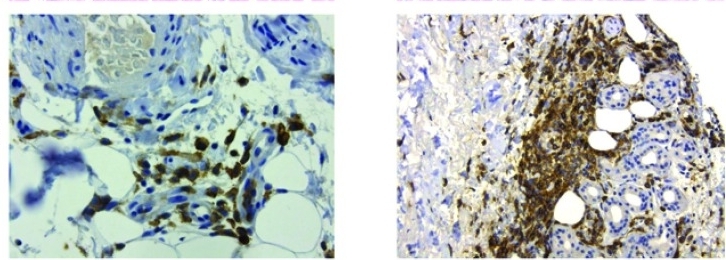 Fig.4 Immunohistochemical images of CAR-T cells. (Ritchie, et al., 2013)