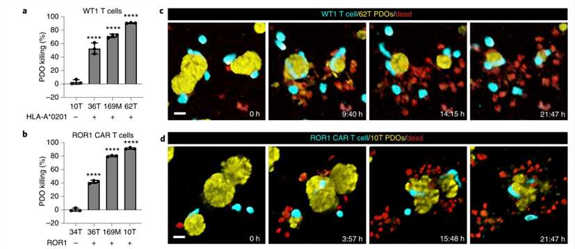 Establishing breast cancer organoids as in vitro models.