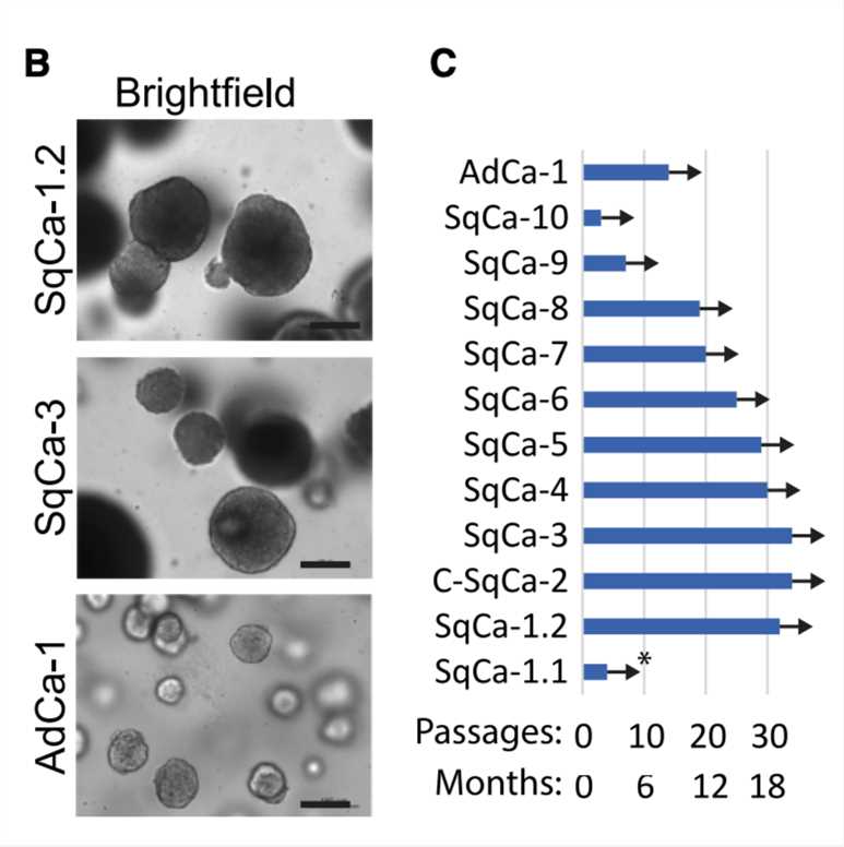 Brightfield image and passage generations of cervical cancer organoids.