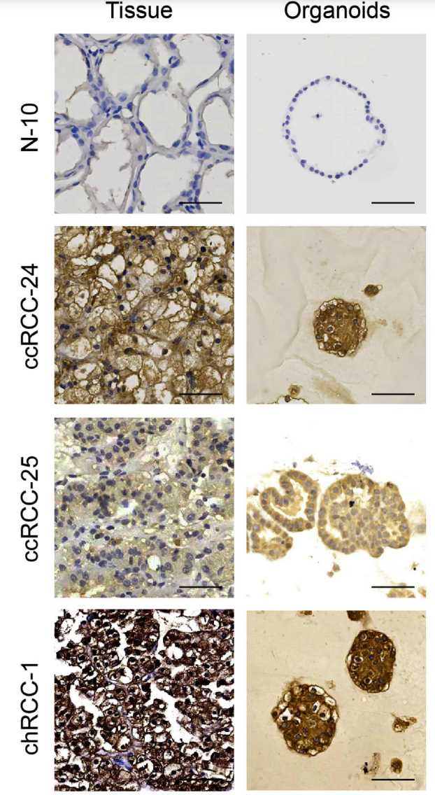 Tumor tissue resembling organoid models are developed and verified for CD70 expression.