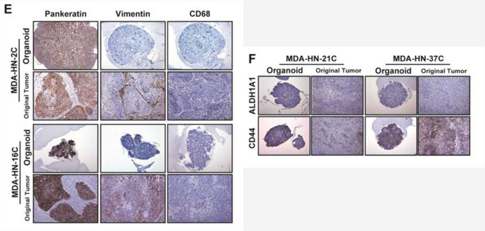 Organoids and original tumors are tested for specific cell populations using IHC staining. 
