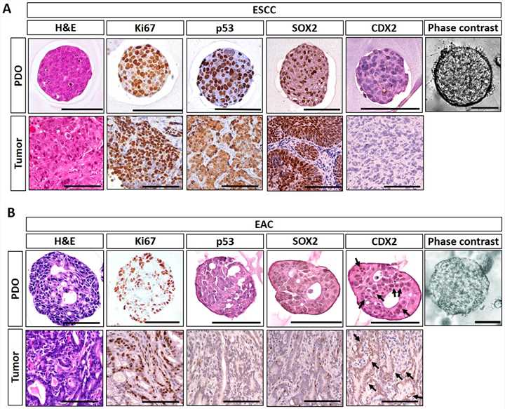 Histological characterization of ESCC and EAC with matched organoid culture.