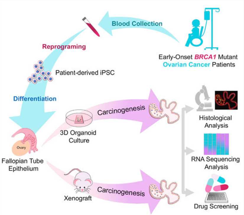 Fallopian tube carcinoma cancer organoids establishment and characterization.