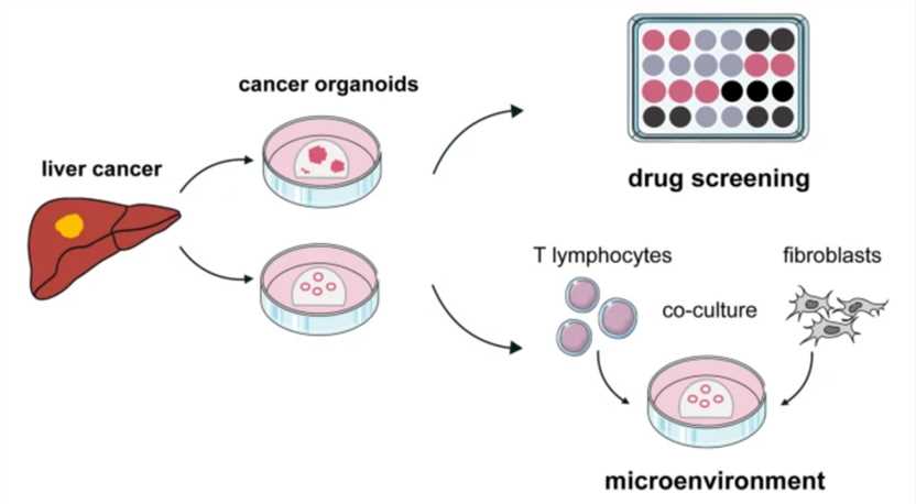 Establishing liver cancer organoids for drug screening and efficacy test.