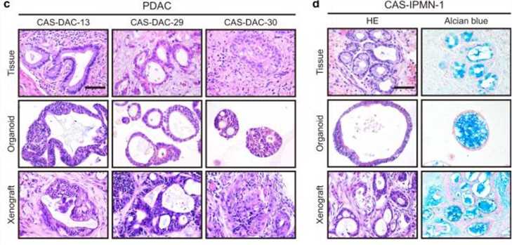 Histological and immunohistological patterns of cancer organoids and tumor tissues.