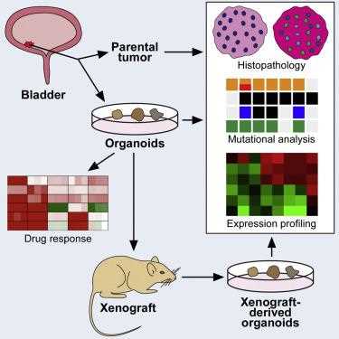 Establishing well-characterized bladder cancer organoids for potent therapy development.