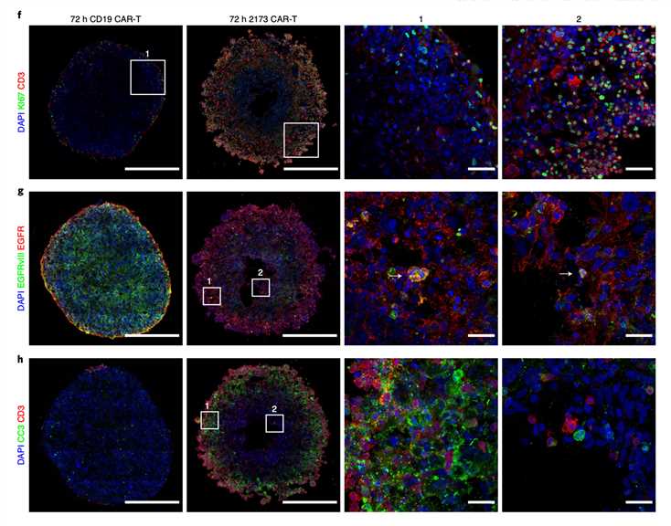 Combined immunohistochemical staining and confocal image to analyze CAR-T cell proliferation, tumor organoids apoptosis and antigen loss after incubation with specific CAR-T.
