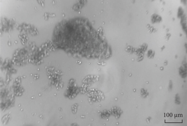 Fig.2 Generation of lentivirus through the HEK 293FT cell. (La, et al., 2021)