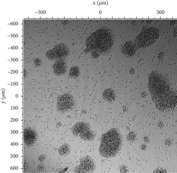 Fig.3 CAR-T cells on confocal microscope. (La, et al., 2021)