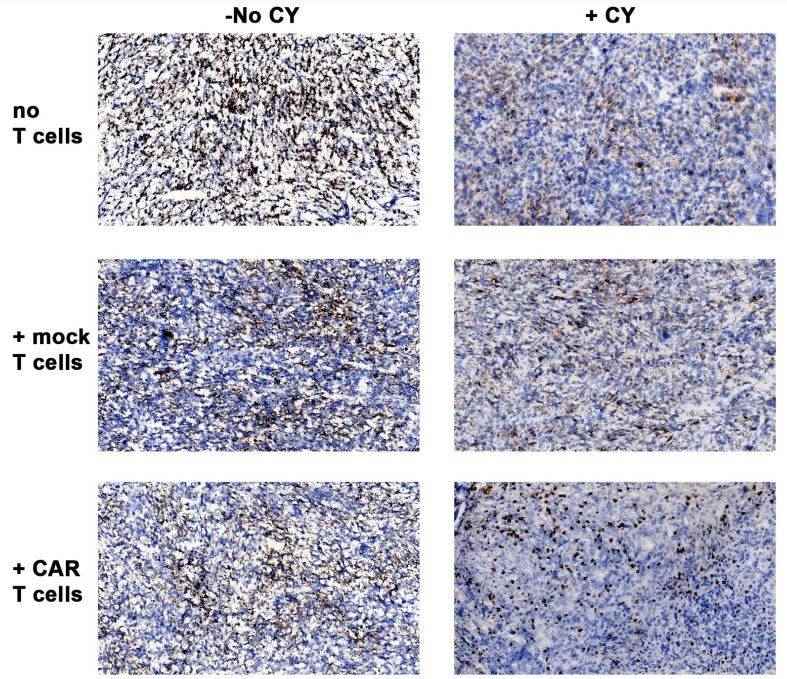 The CEA expression in CEA tumor specimens from CEA-CART cells treated CEATg mouse models (with/without cyclophosphamide (CY)) detected by immunohistochemistry.
