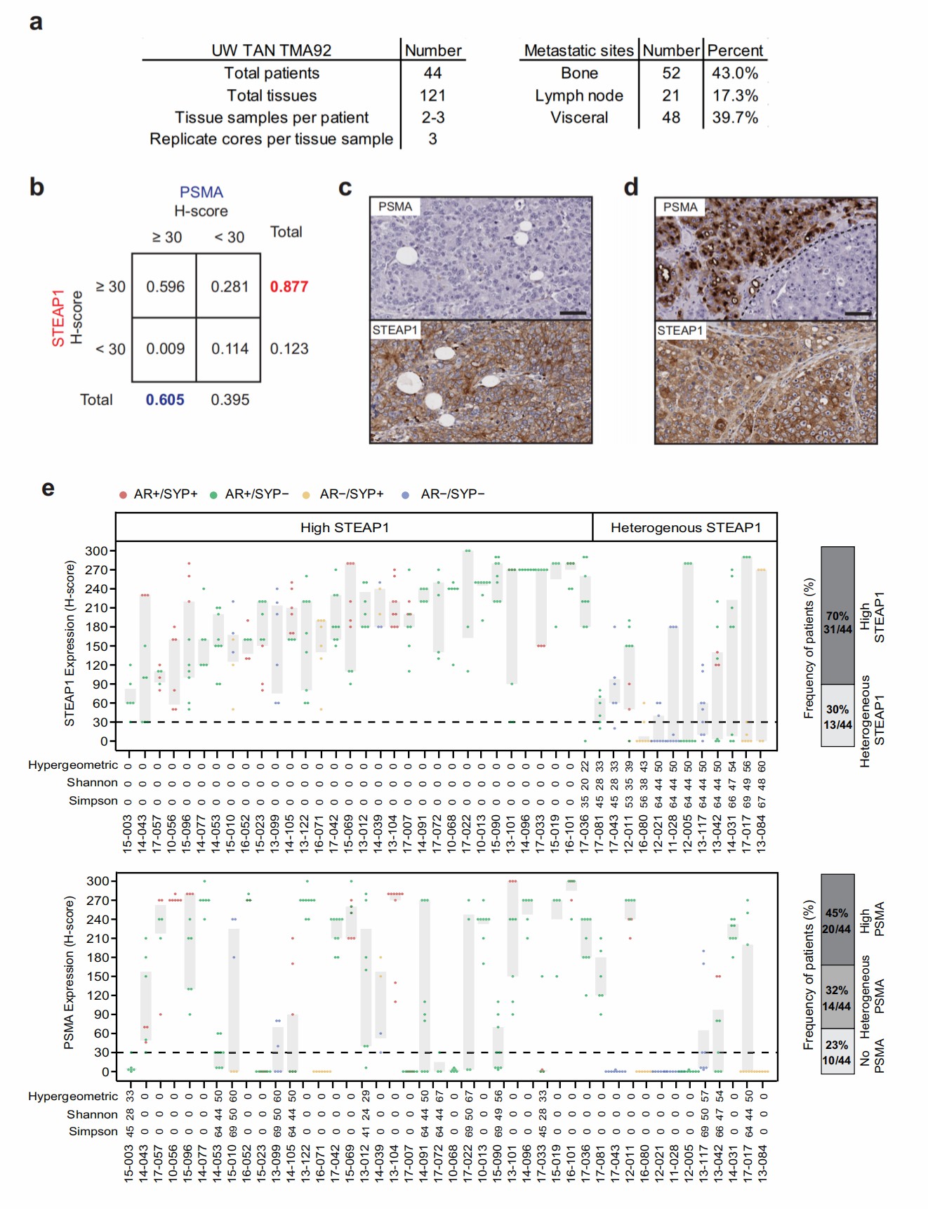 Characterization of STEAP1 and PSMA expression profile in mCRPC patients using immunohistochemistry. (Bhatia, et al., 2023)