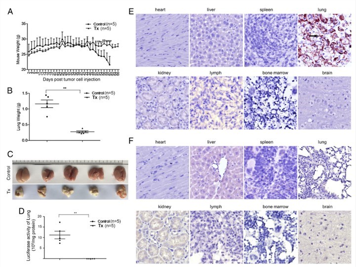 Suppression of metastatic lung cancer by ihv-DC1.2-MAGEA3-primed cytotoxic lymphocytes in NSG mice.