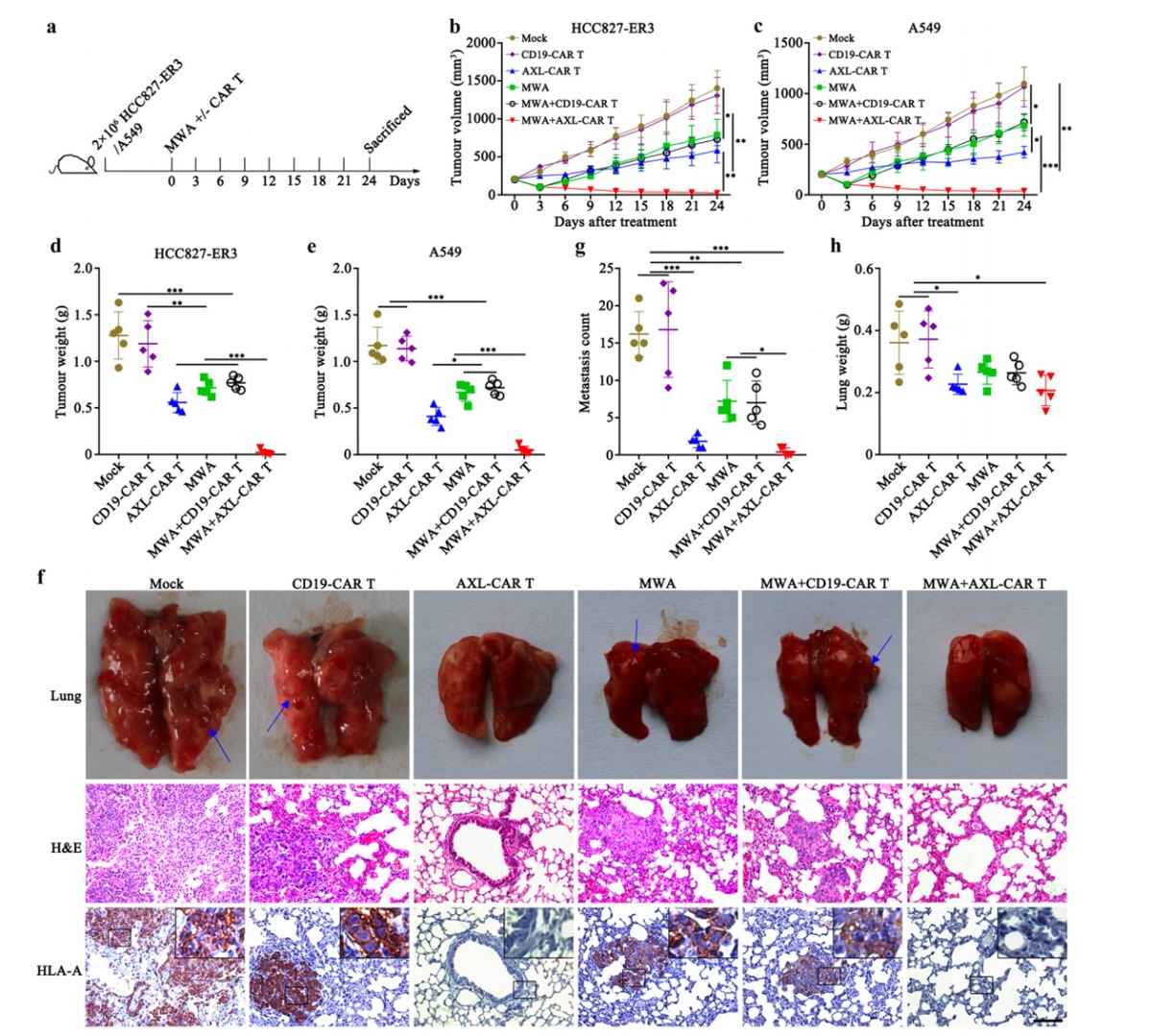 MWA promotes antitumour activity of AXL-CAR T cells against lung cancer.