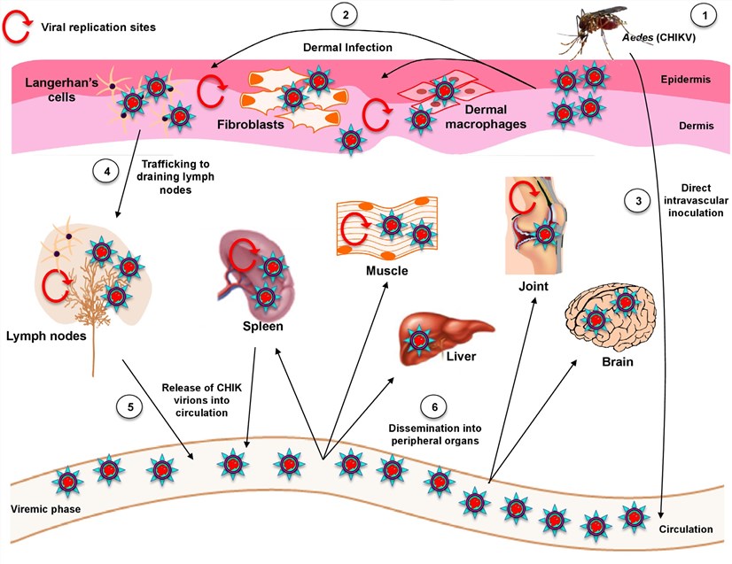 Pathogenesis of CHIKV infection: viral dissemination and impact on host immune response.