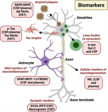 Biomarkers for neurodegenerative diseases. (Wareham, et al., 2022)
