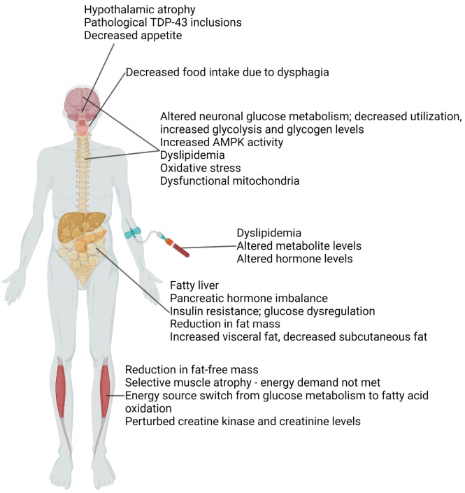 Clinical manifestations of amyotrophic lateral sclerosis.