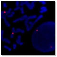 Human chromosome 3 centromere prob