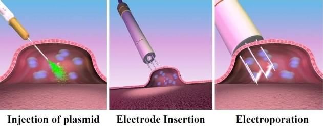 Intratumoral injection of plasmid followed by in vivo electroporation. The interested DNA is administrated by intramuscular or intradermal injection firstly, and then immediately applies electric pulses to the injection site by using appropriate device.