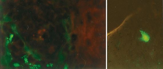 GFP-expressing cells after immunization with plasmid DNA encoding GFP. Left side, expression was observed 24 h after immunization in the mucosa at magnifications of ×540. Right side, expression was observed 24 h after immunization in the dendritic cell in the skin at magnifications of ×270.