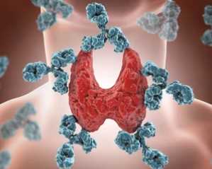 Anti-autoimmune-disorders-specific Antibody Introduction