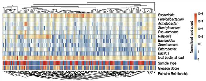 Bacterial composition of prostate microbiome revealed by metagenomic sequencing