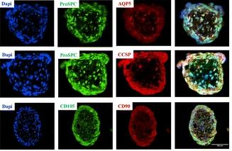 Phenotype analysis of lung spheroids. (Dinh, et al., 2017)