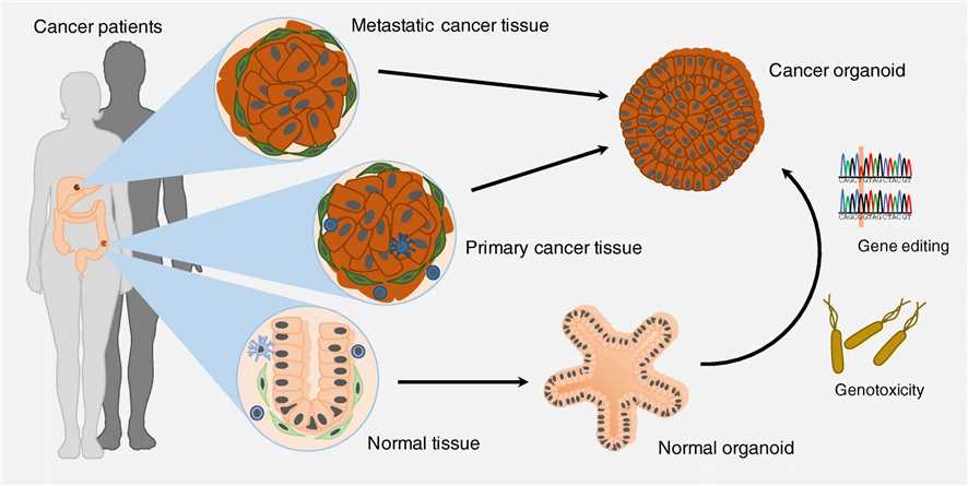 Fig 1. Patient-derived cancer organoids established from primary and metastatic cancer tissue.