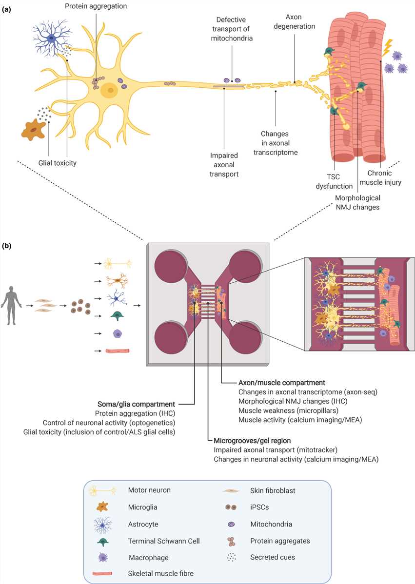 Fig 1. Schematic illustration of some of the disease mechanisms involved in ALS.