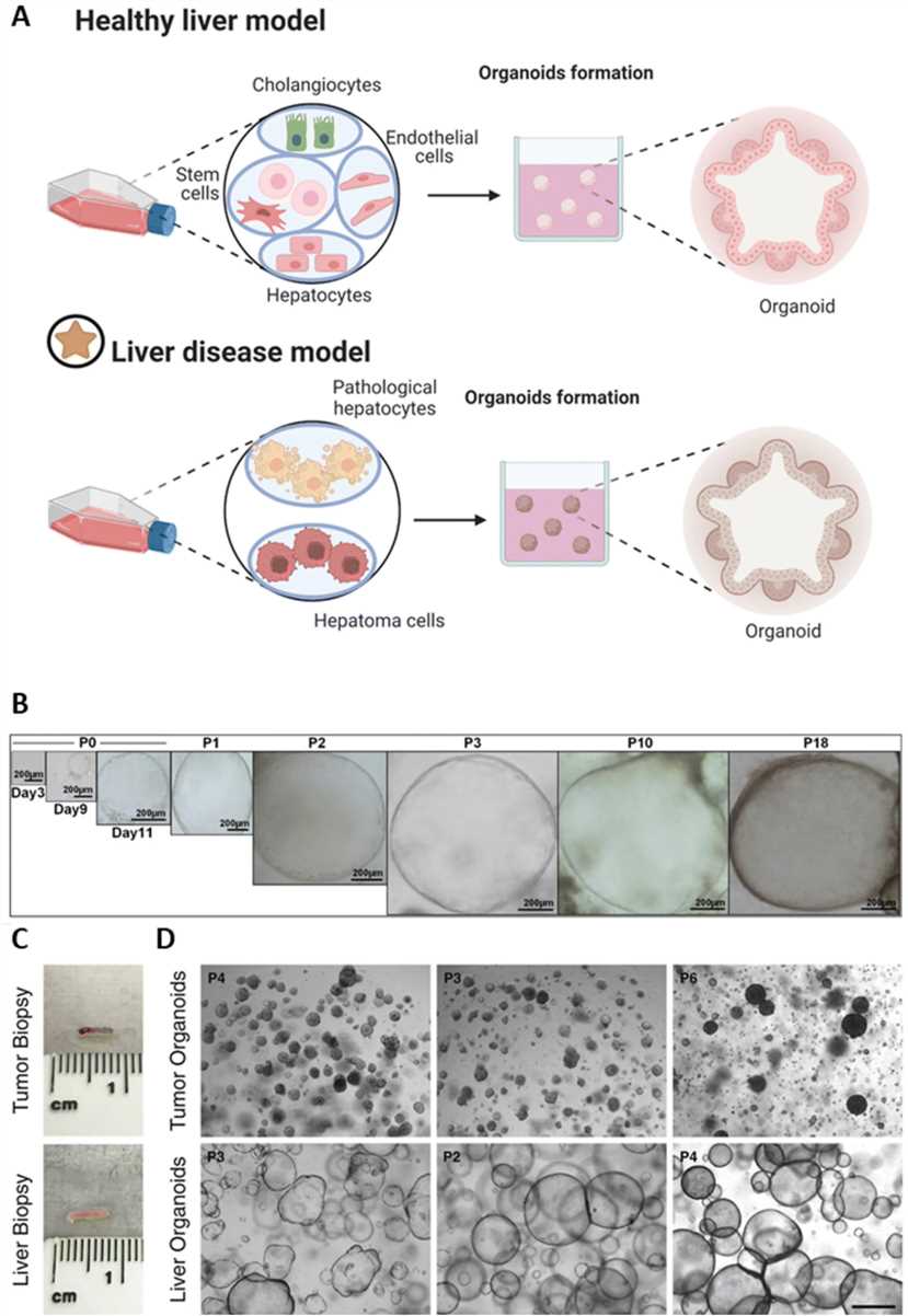 Fig 2. The organoids represent a liver disease model formed from pathological liver cells.