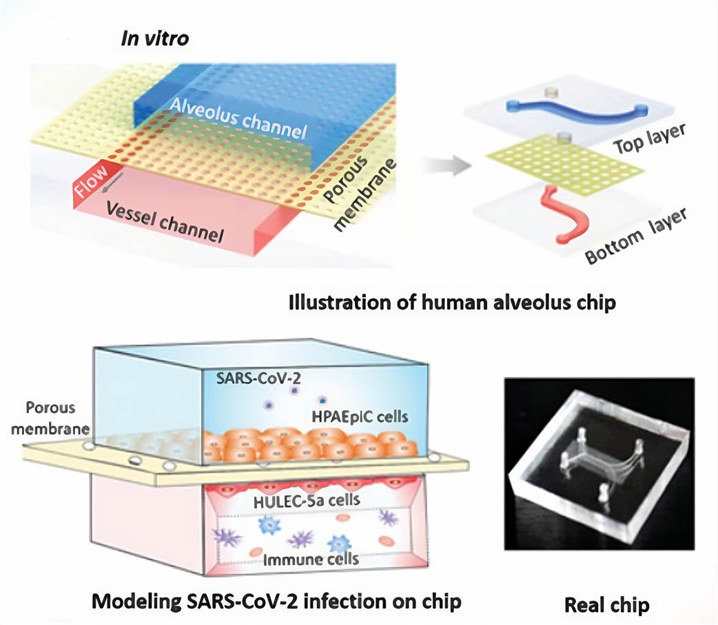Fig 1. Schematic diagram of microengineered human alveolus chip infected by SARS‐CoV‐2.
