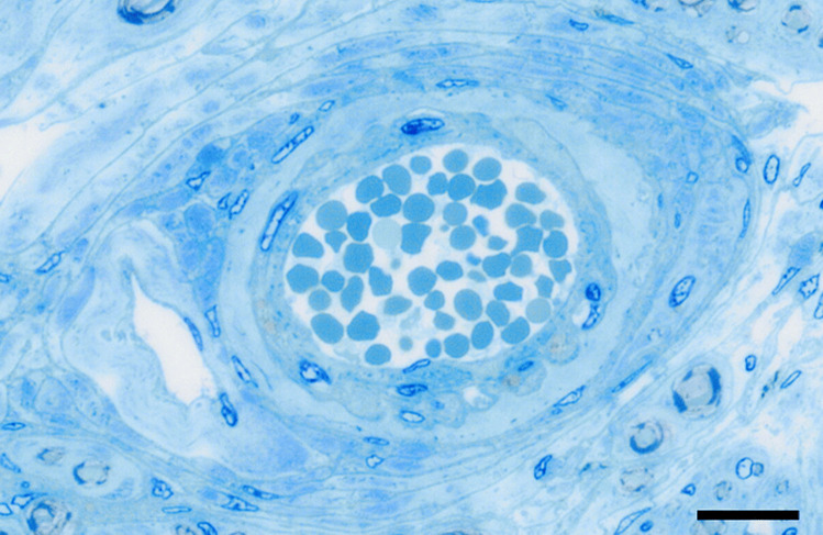 Sectioning of a human dorsal root ganglion at a semi-thin level.