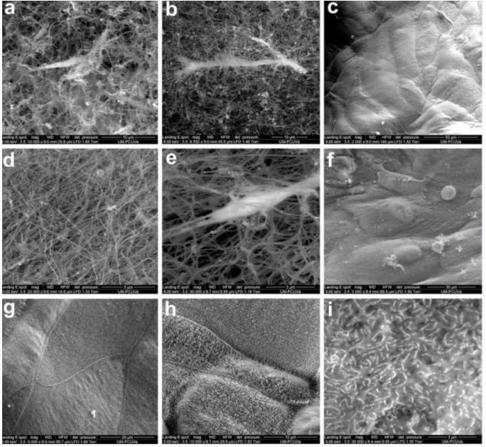 Scanning electron microscopy (SEM) imaging of the eye.