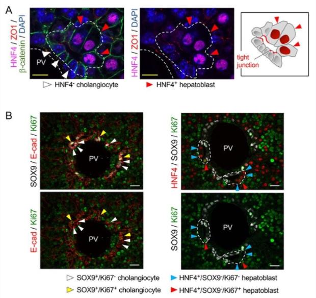 Structural features of cells within the bile duct lumen.