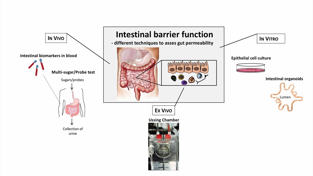 Overview of the different techniques used to measure intestinal barrier function. 