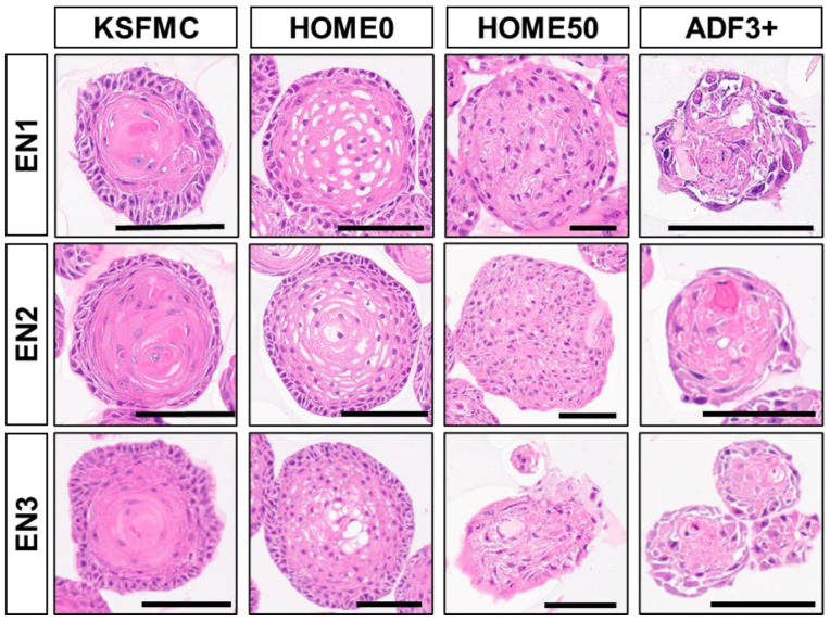 Patient-derived organoids (PDOs) from normal esophagus reproduce the squamous epithelium differentiation gradient under specialized culture conditions.