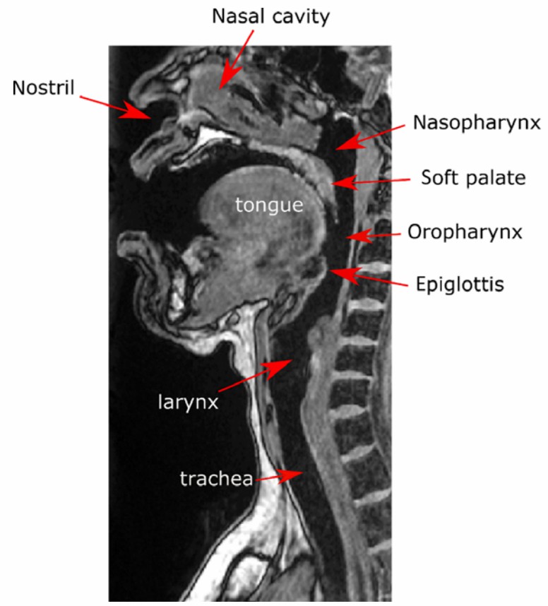 Magnetic Resonance Imaging data of a healthy subject used to create the upper airway model.