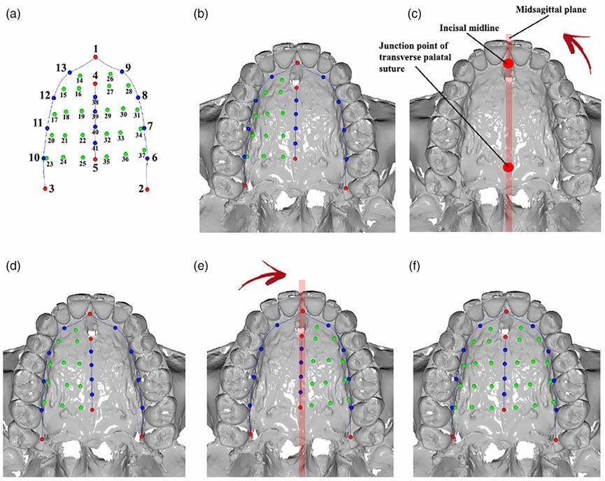 A human palatal arch tissue model marked with key anatomical landmarks.
