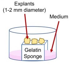 Schematic diagram of three-dimensional in vitro culture of pancreatic tumor tissue.(Kokkinos et al. 2021)