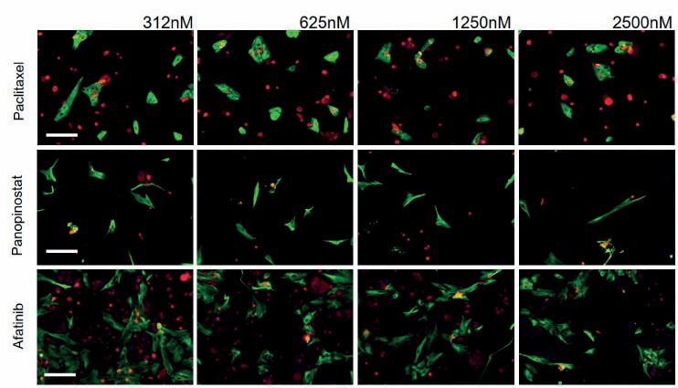 Parotid gland ex vivo drug screening. (Nykanen, 2021)