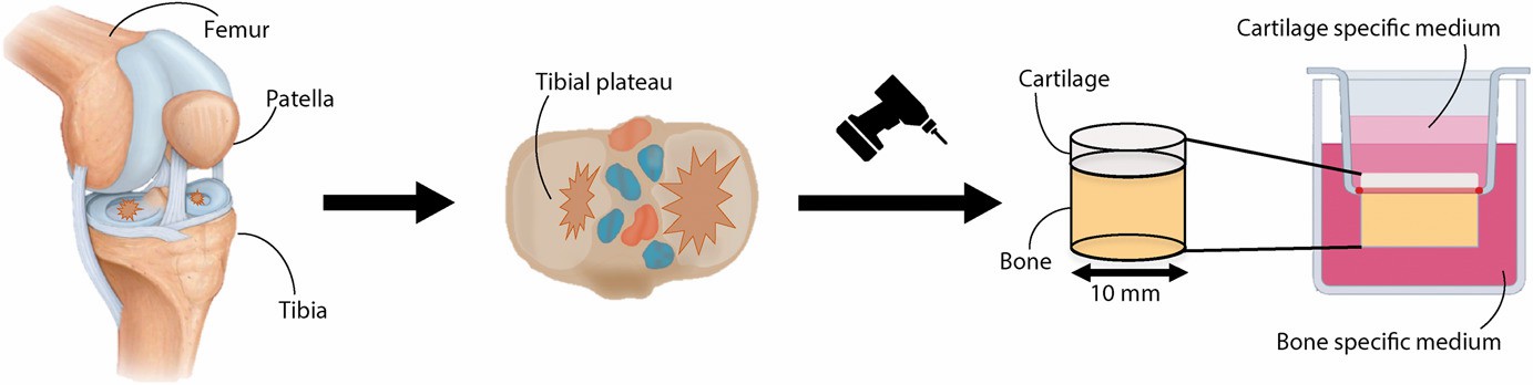 A system for collecting and culturing osteochondral tissue samples.