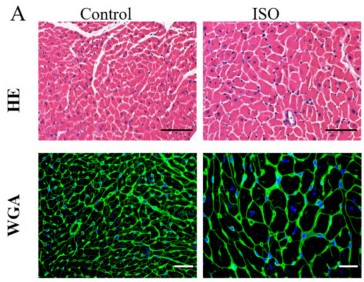 Isoprenaline induces cardiac hypertrophy.(Li, 2023)