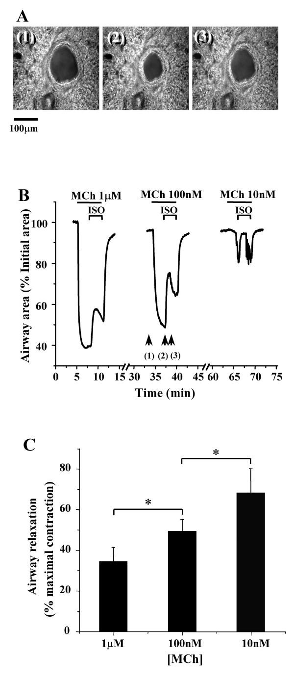 Contraction and relaxation test of airways under ISO
