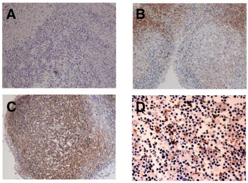 Examination of tonsil tissue samples for B95-8 infection through histological methods.