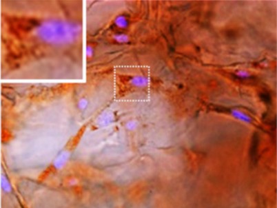 Adipose tissue. (Urkia, 2022)