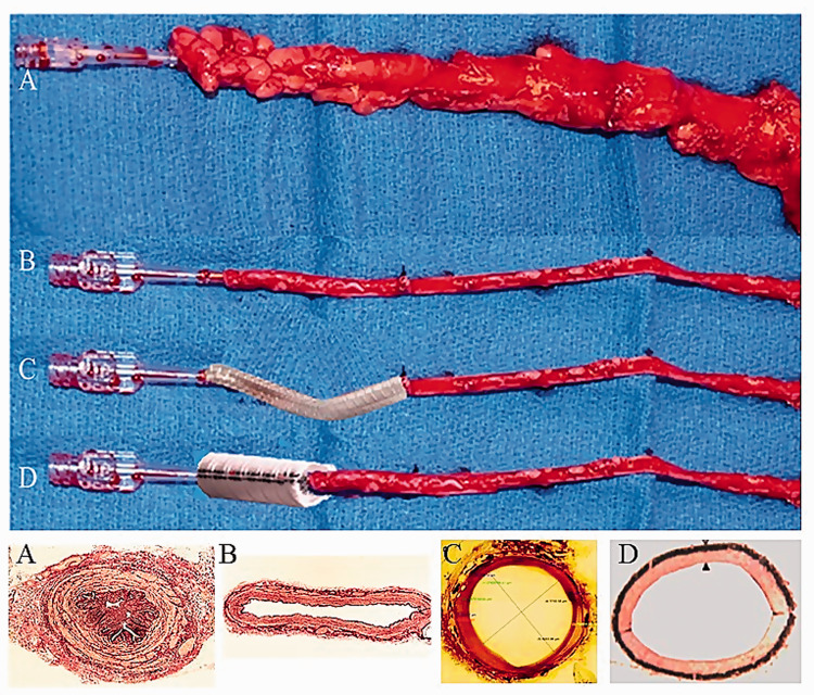 Anatomy and histology of the saphenous vein.