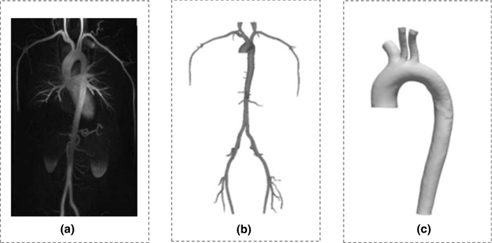 MRI and 3D reconstruction of the aorta and its branches in a healthy man.