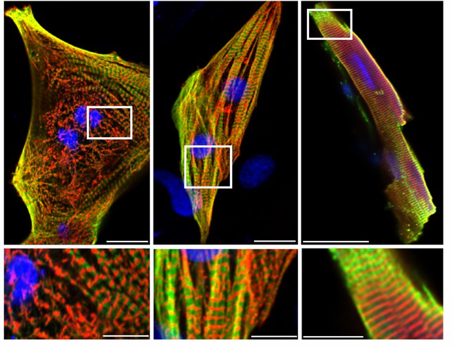 Histoimmunological observation of human atrial tissue.