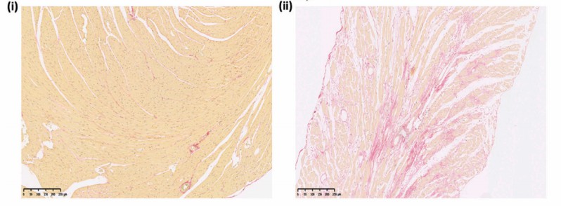Representative example of the absence of fibrotic change in old WT ventricles and the presence of fibrotic change in old Pgc-1α−/− ventricles obtained by histological analysis.