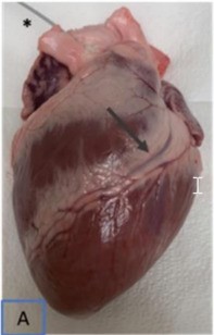 Location of the coronary arteries on the surface of the heart.